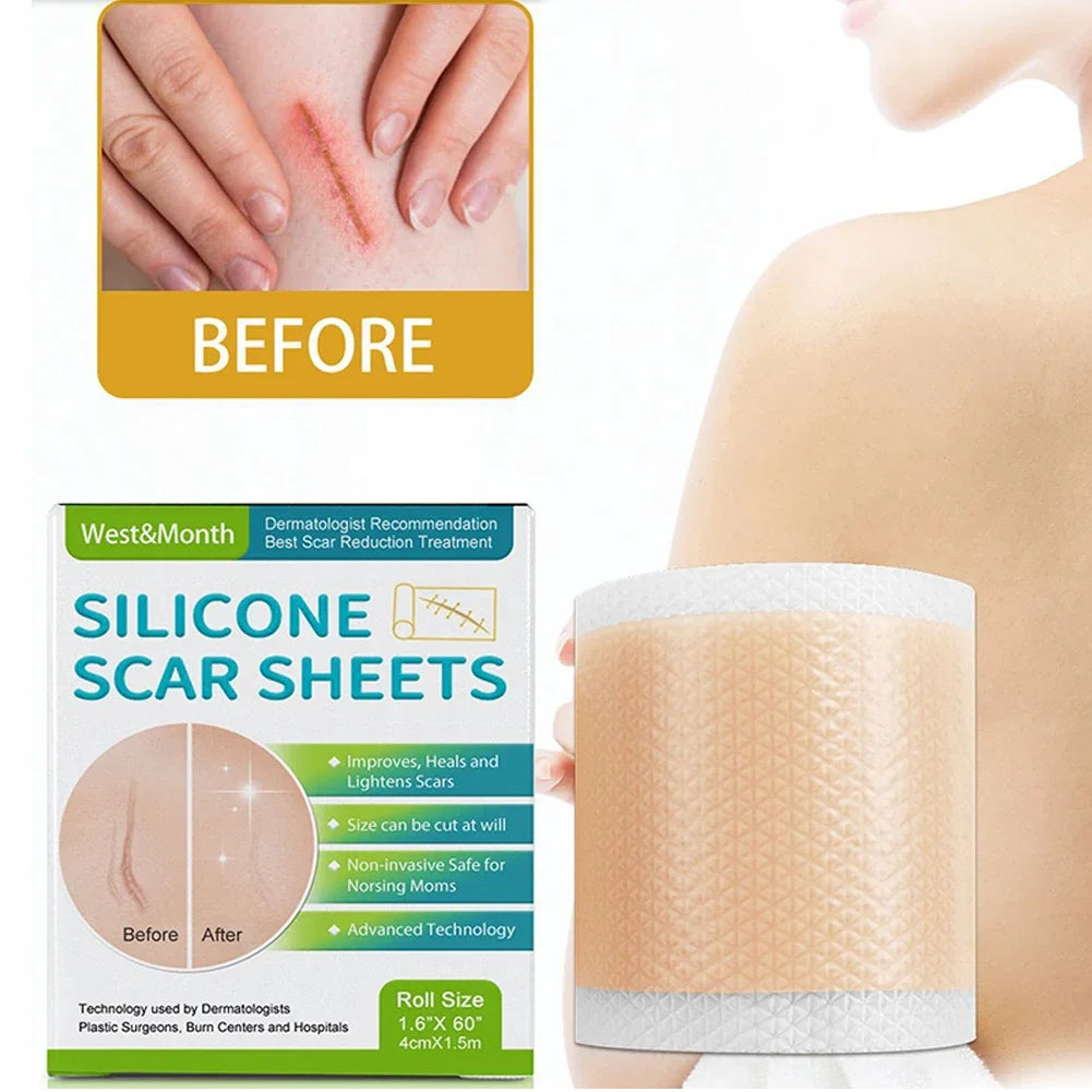 Silicone Scar Sheets Painless Scar